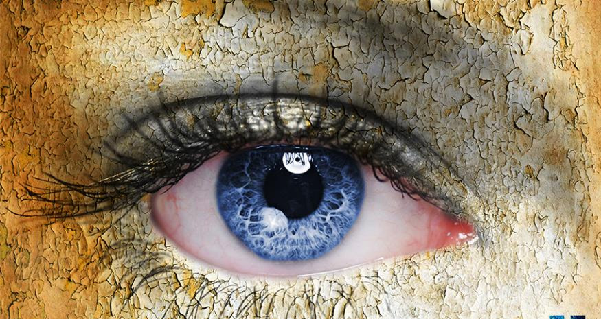 Göz Kurluğu “Kuru Göz Sendromu” Tedavisi