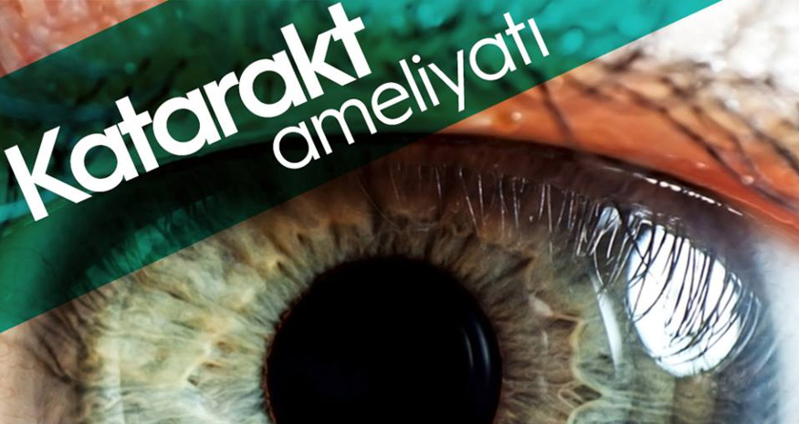 Katarakt Ameliyatı Nedir, Nasıl Yapılır, Riskleri Nelerdir?