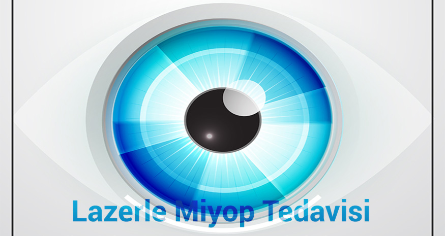 goz tedavileri 444 31 99